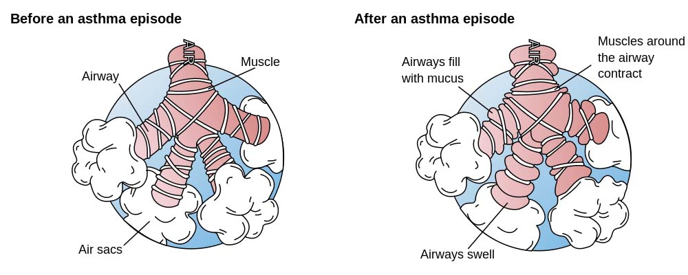 آسم-آناتومی دستگاه تنفسی (بخش اول)