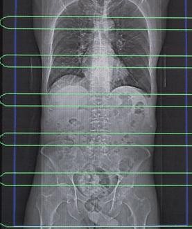 CT اسکن شکم و لگن - پرتو رسانه