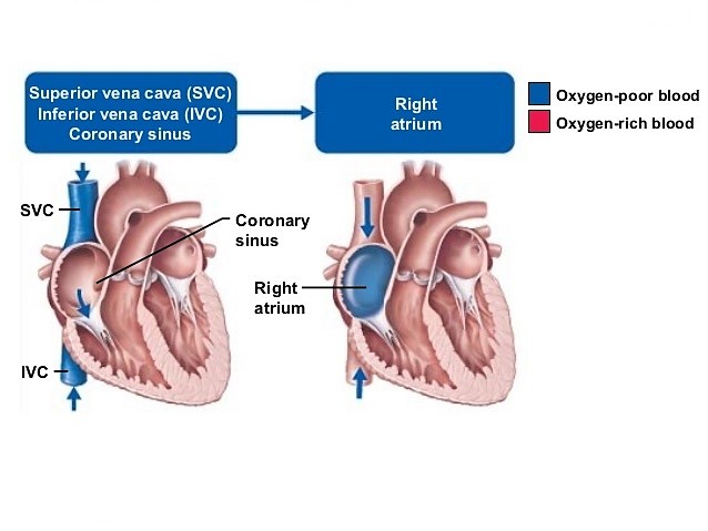 آناتومی قلب و عروق مجاور (بخش دوم)- دهلیز راست، وریدهای اجوف تحتانی و فوقانی