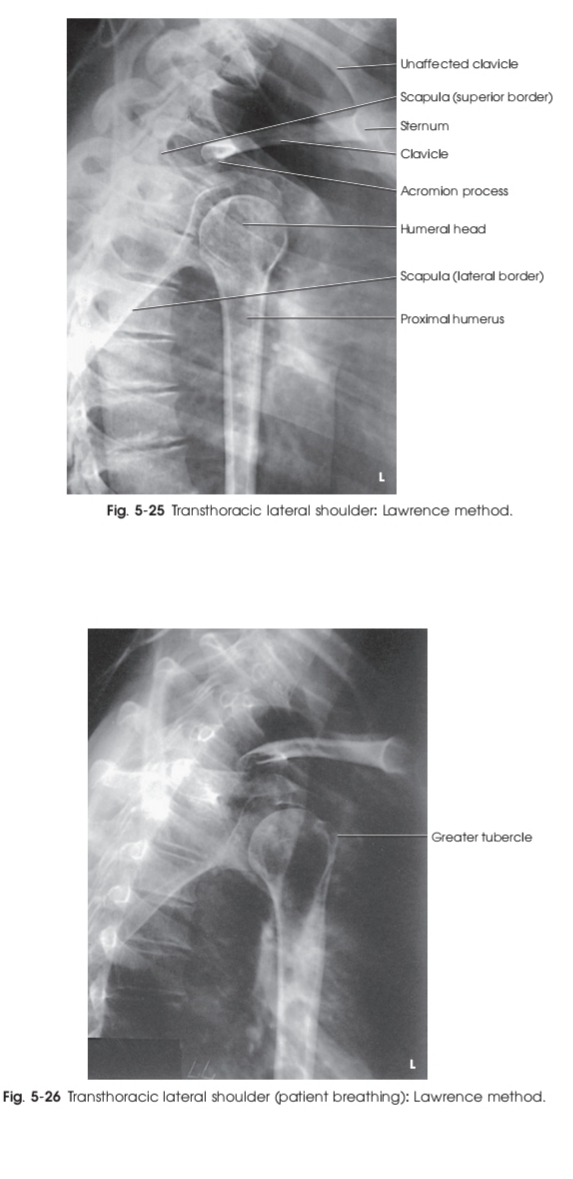 تکنیک های رادیوگرافی مفصل شانه (بخش اول)