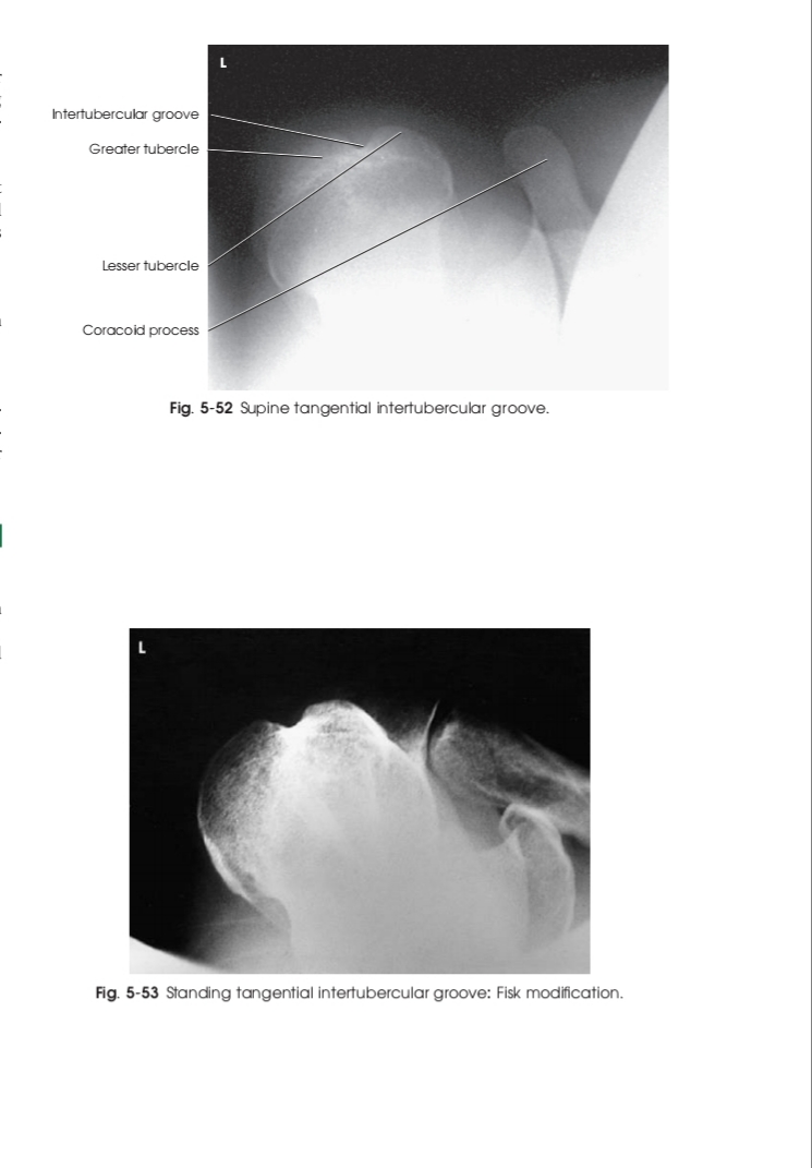 تکنیک های رادیوگرافی مفصل شانه (بخش دوم)
